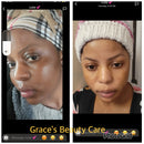 Facial Blemishes Dark Set
