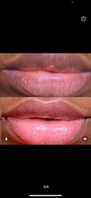 Forever Pink lips Set