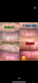 Forever Pink lips Set