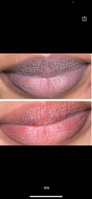 Forever Pink lips Set