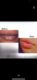 Forever Pink lips Set