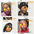Facial Blemishes Dark Set